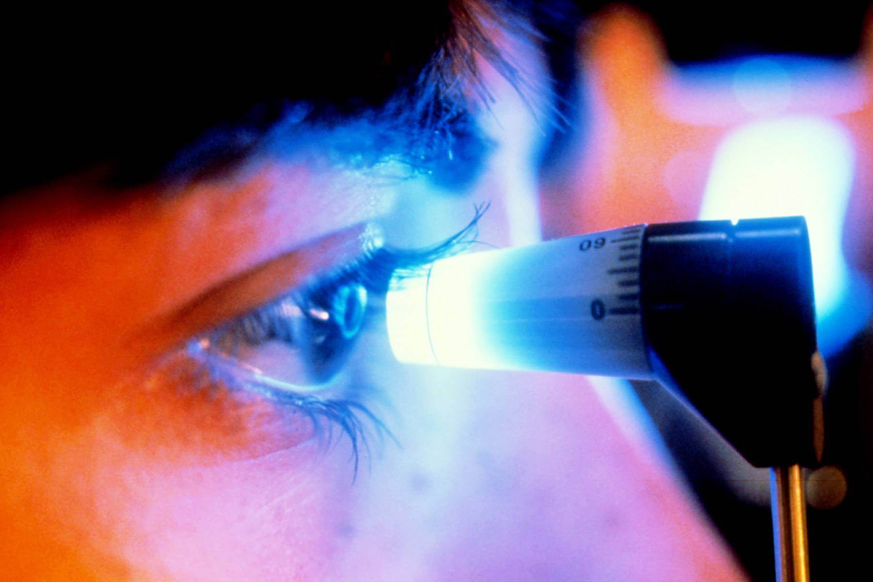 The Relation Between Glaucoma and Eye Pressure